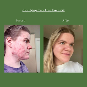 CLARIFYING TEA TREE FACE OIL